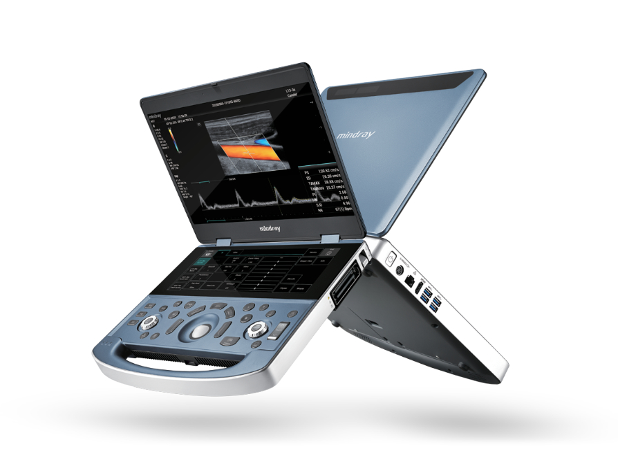 Mindray MX7 portable ultrasound system