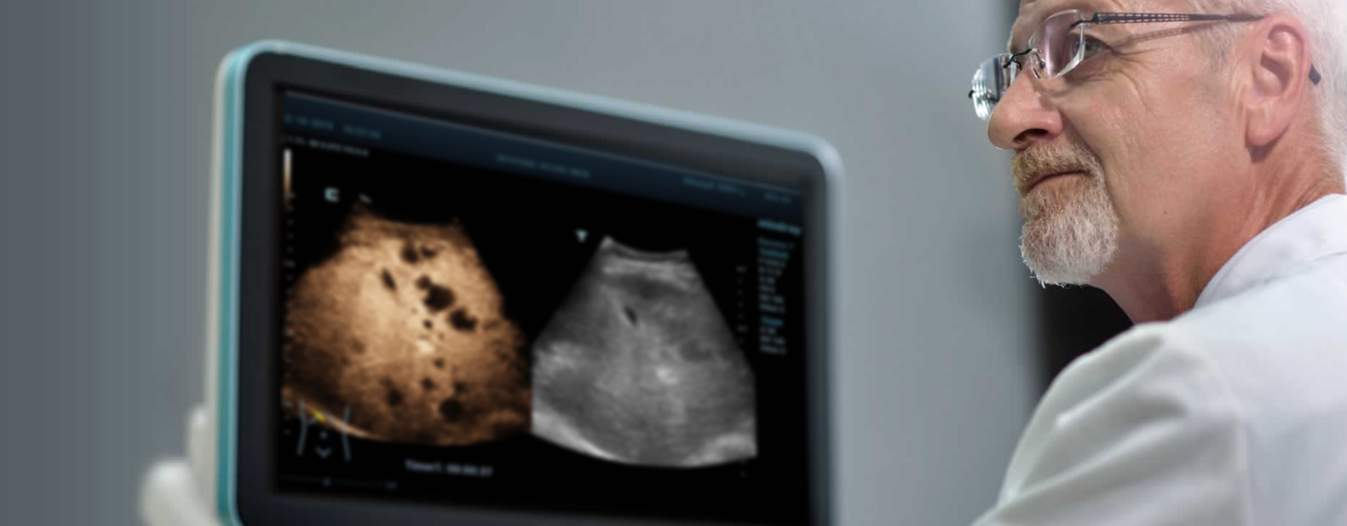 Mindray Resona 7 Premium Ultrasound System