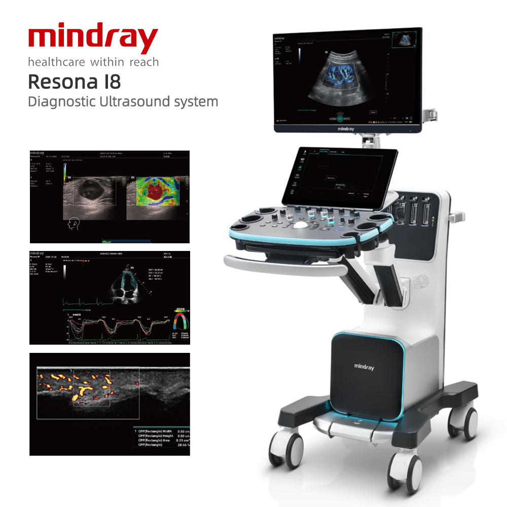 Mindray Resona I8 diagnostic ultrasound system