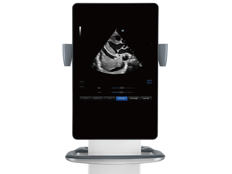 Mindray TE9 diagnostic ultrasound system